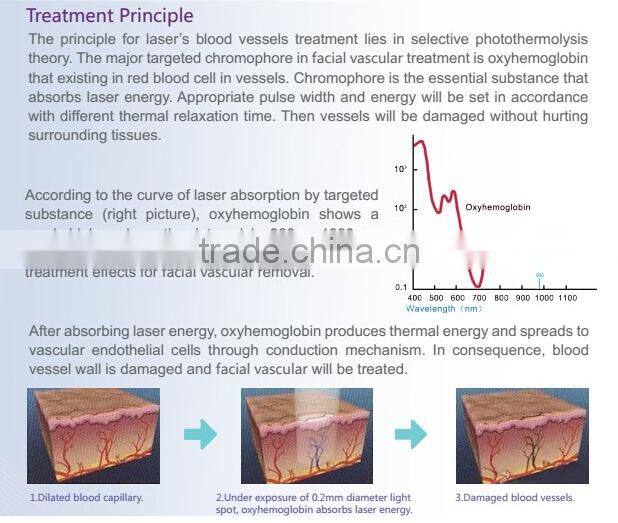New technology optical fiber 980nm diode laser portable vasular removal medical instrument 980nm