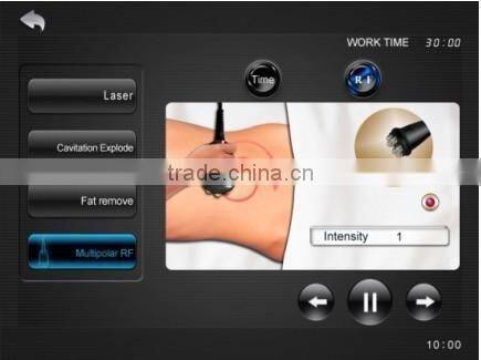 lipo laser cavitation