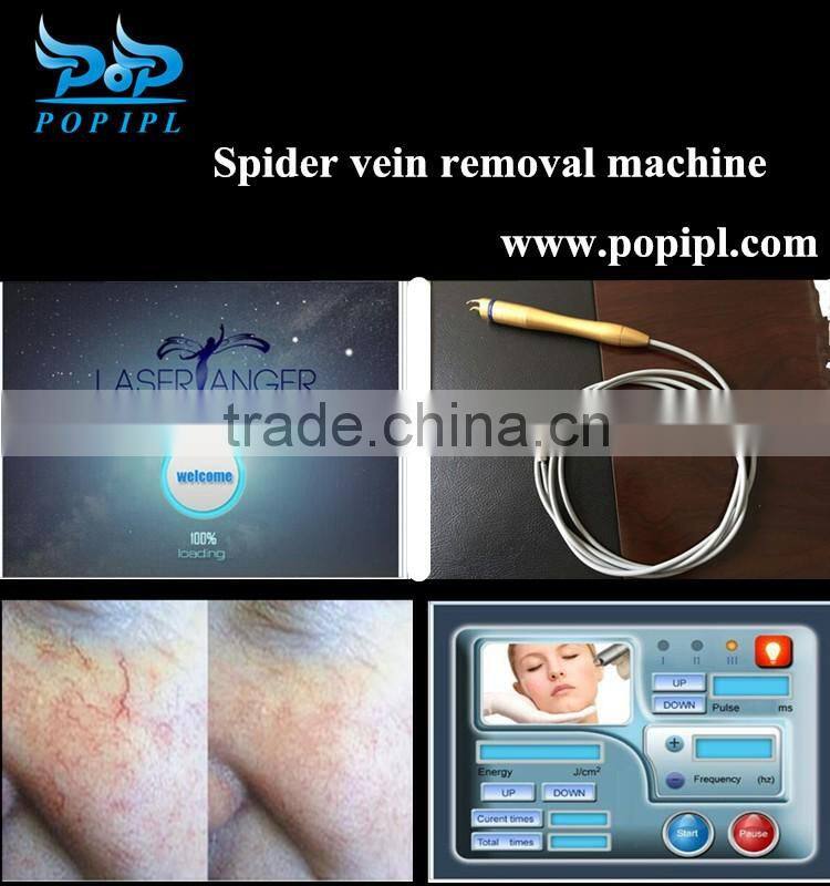 laser Spider vein removal 15W high power / Vascular removal / Blood vessel removal