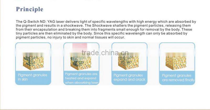 1064nm/532nm Q switched nd yag laser tattoo removal acne removal beauty device--QS-I