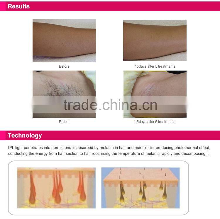 With 150000shots lamp life Factory Home use IPL laser hair removal machine