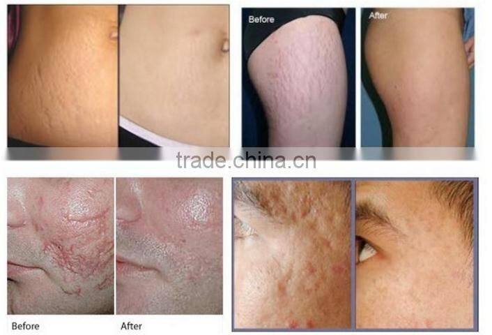 Hot Sale Co2 Cartridge 16g with High Quality