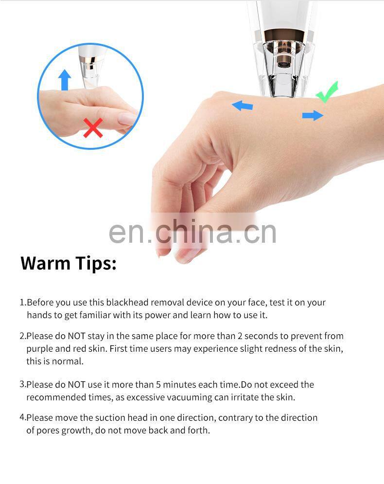 Popular Facial Beauty Blackhead Remover Tool Kit Stock Blackhead Removal with Advanced Vacuum Technology