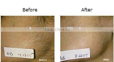 New Design IPL Machine RF Equipment Mutifunction E-light Beauty Device-C003