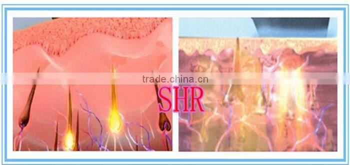 10 milliion shots lazer hair removal 808nme light laser hair removal machine