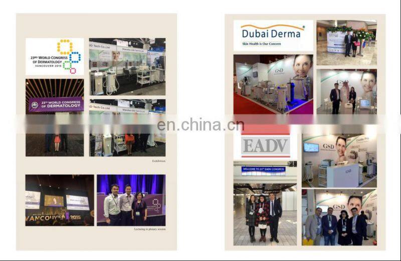 GSD 810nm diode laser permanent hair removal