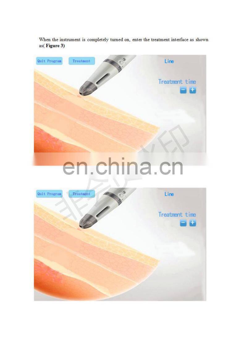 SEE YOU skin care whiten and wrinkle removal needleless injection skin tighten equipment