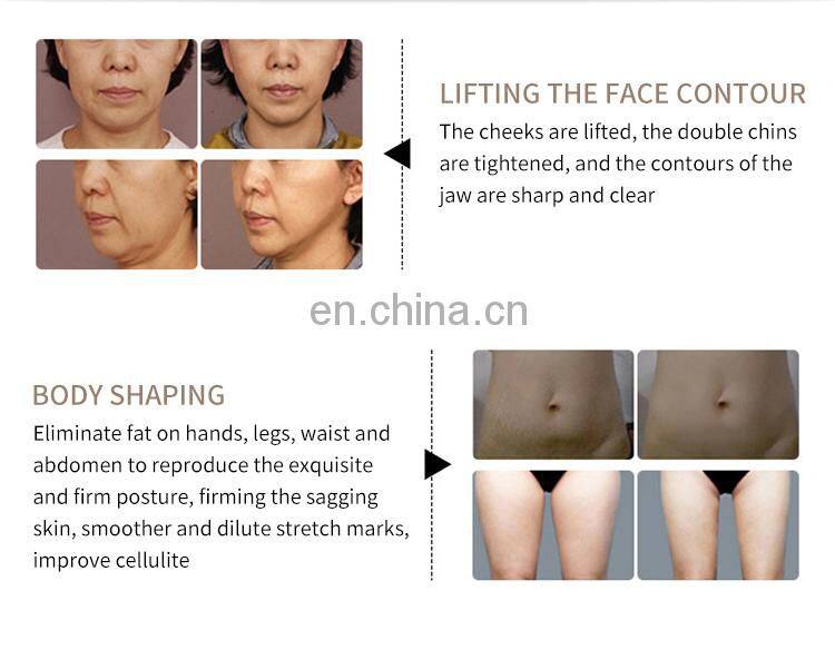 12 in 1 Korean small bubbles