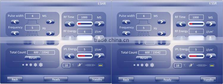 2016 best professional soprano SHR Elight ipl laser hair removal machine