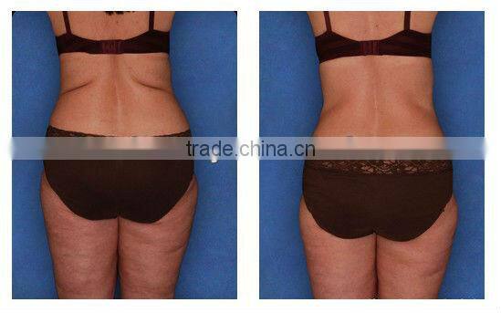 Jimpness Beauty Fat Loss Infrared Fat Burning Massager F019