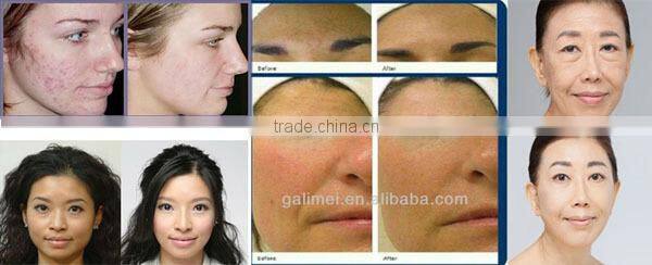 Innovative technology needle-free injection equipment for body beauty