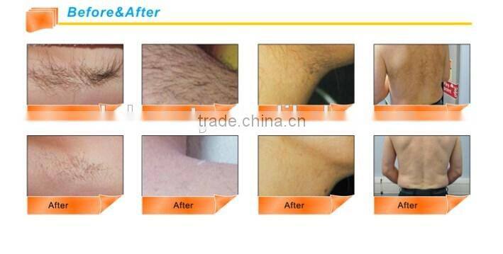 Professional CE approved ipl and skin rejuvenation hair removal beauty equipment