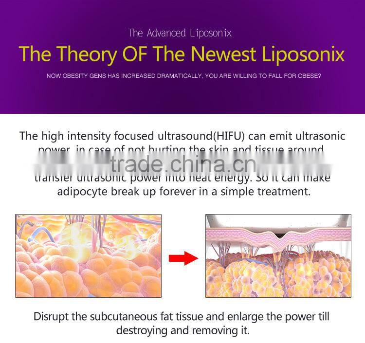 The Hifu High Intensity Focused Ultrasound Machine For Body Slimming