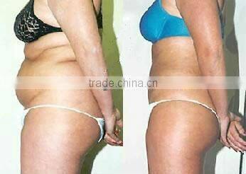 Body&Face Cavitation Slimming mahcine&Dissolve Fat Machine with CE certificate F019