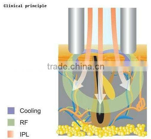 Fractional photoepilation ipl+rf machine elight machine for hair removal and skin rejuvenation C006