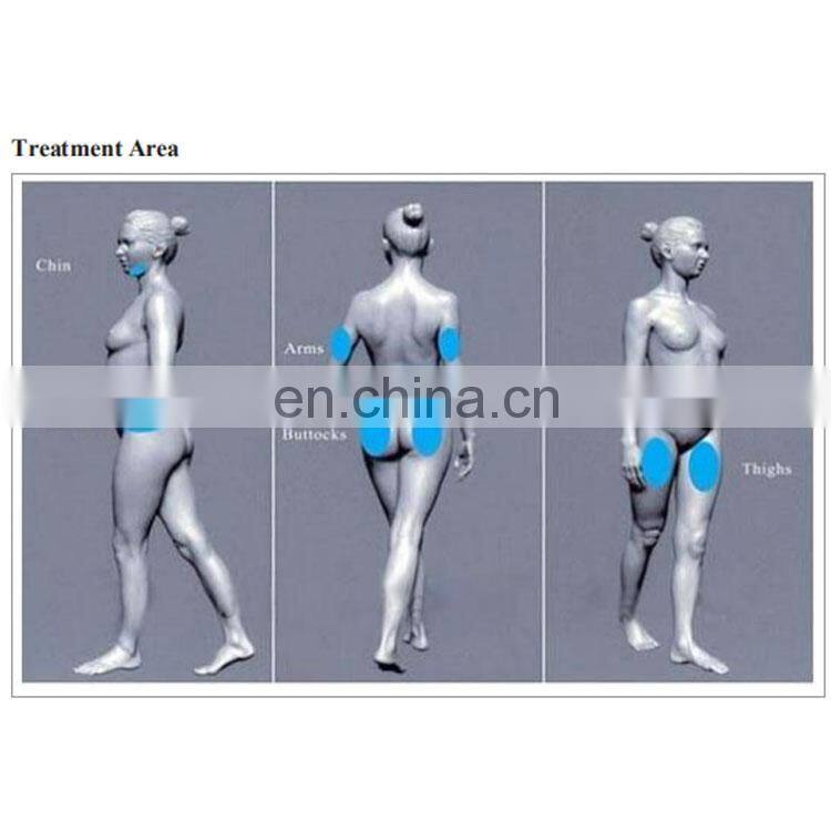 2022 Best 360 Degree Cryo Reduce Fat Slimming Cryotherapy Cryolipolysis Machine