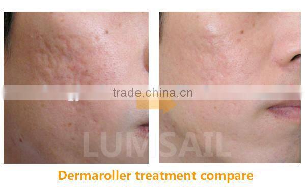 High quality dermaroller micro needle electrical derma pen for skin care