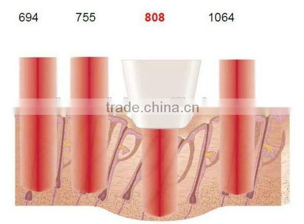 Professional Cosmetic Elight Skin Rejuvenation plus 808nm Diode Laser beauty equipment