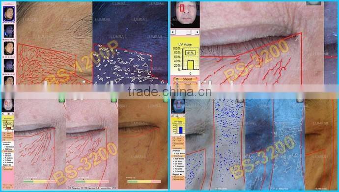 Portable Facial Magic Mirror Skin Analyzer