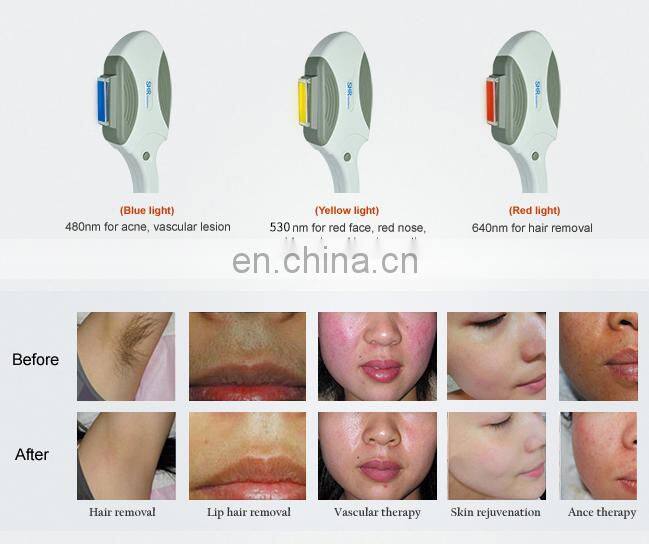 Portable painless electric 480nm 530nm 640nm wavelength IPL OPT SHR hair removal  machine