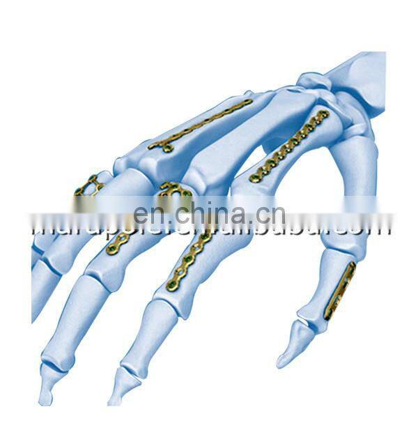 Maxillofacial system plate for surgery implants,orthopedic implants,hand plates
