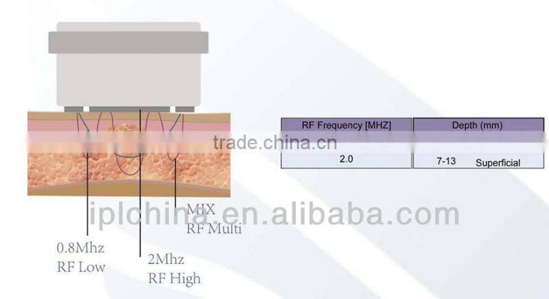 2014 Multi-Frequency Radio Frequency Face Toning Device-Cellactor