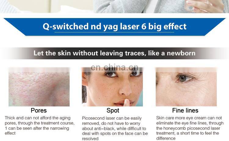 NEW Laser Picosecond for Tattoo Removal q switch pico laser 1064nm 532nm 755nm tattoo removal device