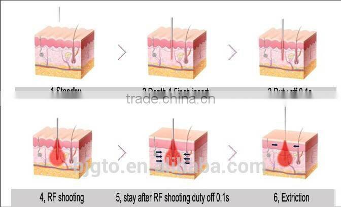 2014New Professional micro needle RF fractional machine skin rejuvenation,wrinkle removal,skin tighten