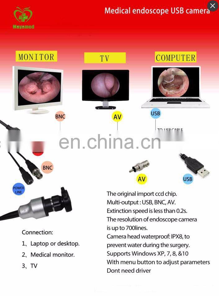 Mini portable android/iphone/smartphone ent endoscope camera video endoscope price