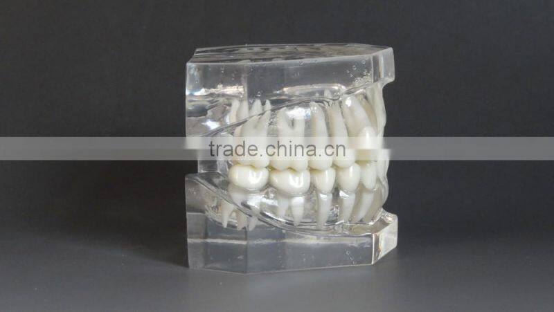 Malocclusion Classification Demonstration Model 1