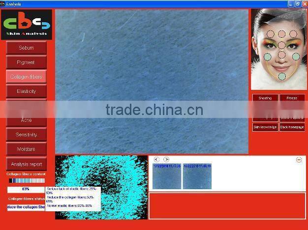 2015 Latest 3D Skin Analyzer/ Skin Analyser(English version software)