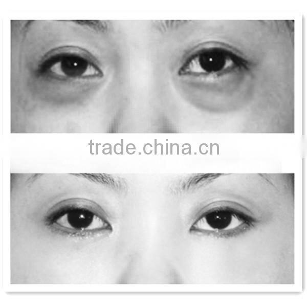 Fractional rf eye beauty machine for sale