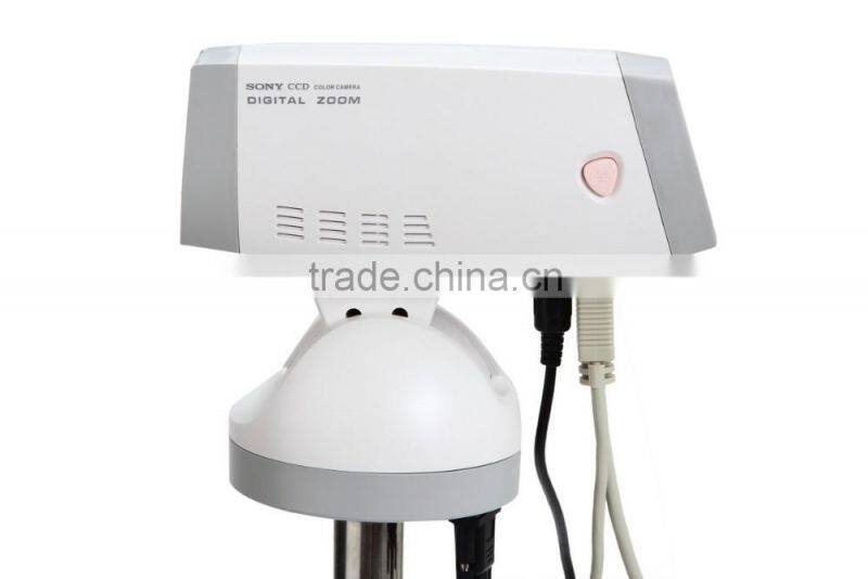 Medical Equipment Portable Digital Camera Vaginoscope Colposcope