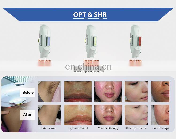 For spa OPT + Fractional RF + Nd Yag Laser 3 in 1 Skin Tightening Tattoo Removal Permanent Hair Removal for men