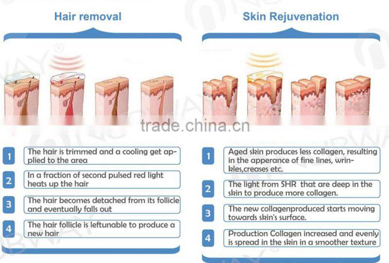 New high energy best professional new style shr /opt/aft ipl elight rf laser hair removal machine