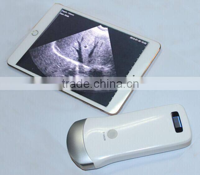 MSLPU31K Wireless Sector Ultrasound Probe