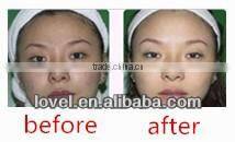 Beauty Skin Needle Free Meso Therapy (LV-M1, CE approval)