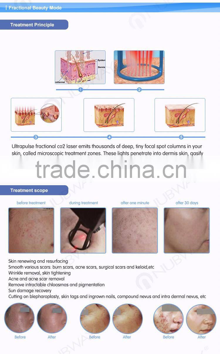 Fda approved co2 fractional laser machine / 30w Fractional Co2 Laser Surgical Products vaginal tightening equipment