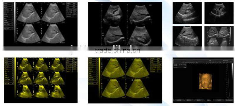 CE approved Laptop PC Ultrasound Scanner /Ultrasonic scanner with 3.5Mhz multi-frequency convex probe RUS-9000E2