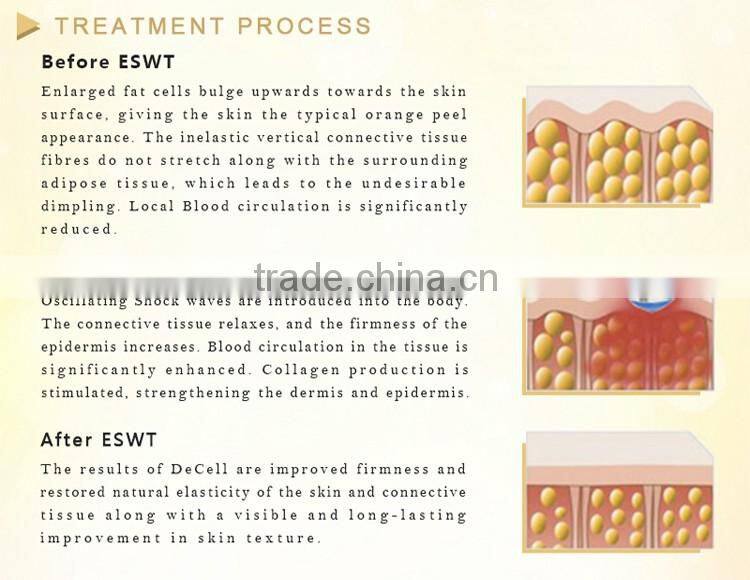 10HZ eswt electro shock wave therapy machine for slim body
