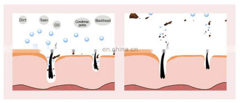 New multi-function beauty massage tool portable ultrasonic electric ion facial massager