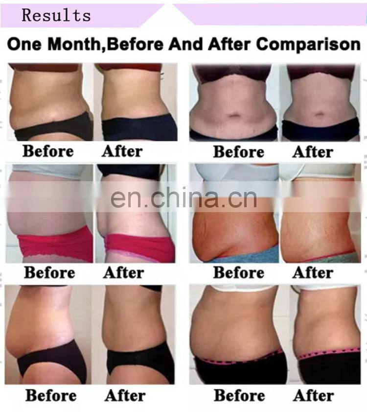 Body Slimming Machine Monopolar RF CET RF RET Machine Of Good Effects