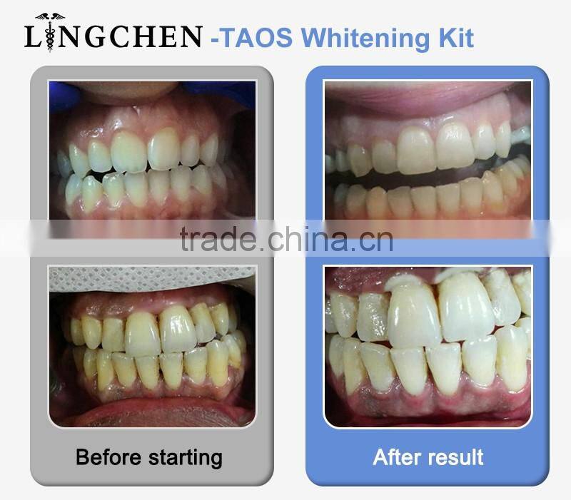 Hot Sale Best Tooth Whitening Kit,home teeth whitening kit/Five-patient Whitening Kit