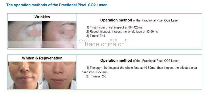 CO2 pixel laser for beauty salon/ Pixel laser /Pixel laser Co2 machine