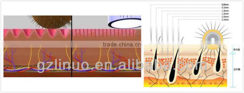 2013-2017 the most professional +powerful 540 derma rejuvenate