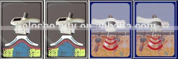 China Vertical Slimming Machine,Cryo Slimming Machine,Body Shaper Slimming Machine