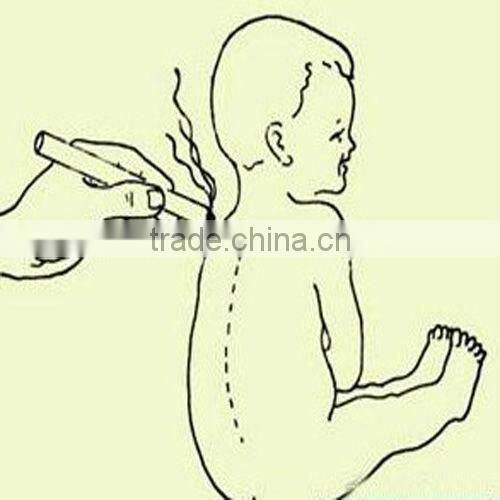 Chinese Traditional moxibustion used pure Moxa Roll