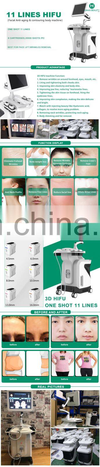 hifu 9d/ trolley hifu/hifu korea body