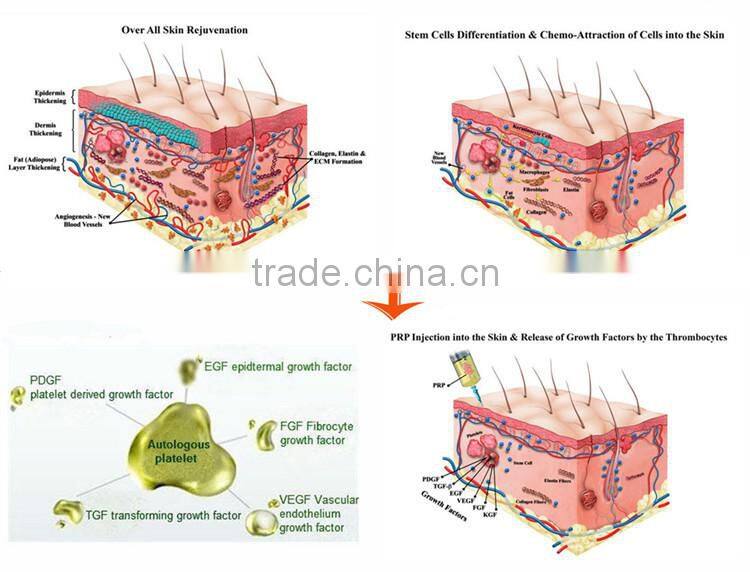 advance sealed caps syinges fat and blood plasma extract centrifuge TD4-MR