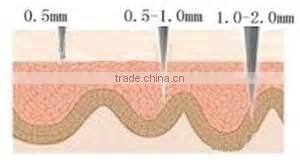 NL-DRS540 derma roller Micorneedle with Gold hanle for skin rejuvenation Anti-aging treatment beauty derma rolling system